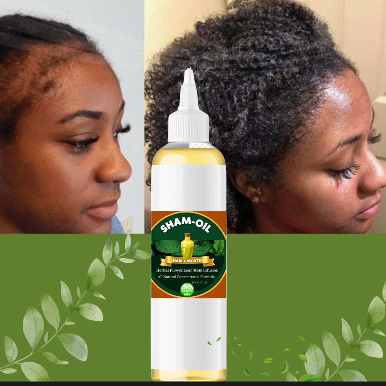 Hair growth oil-4ounces
